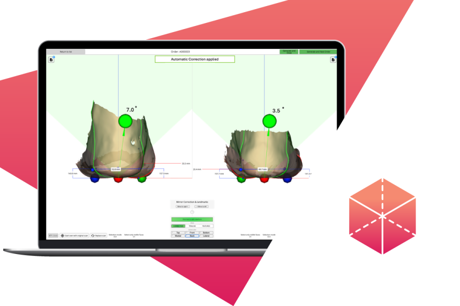 Using AI to Calculate Calcaneus Alignment in Foot and Ankle Applications